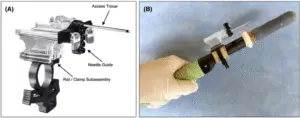 PrecisionPoint System used during Trasperineal prostate biopsy