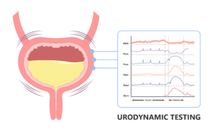 Specialised urodynamic equipment recording bladder pressure and urine flow