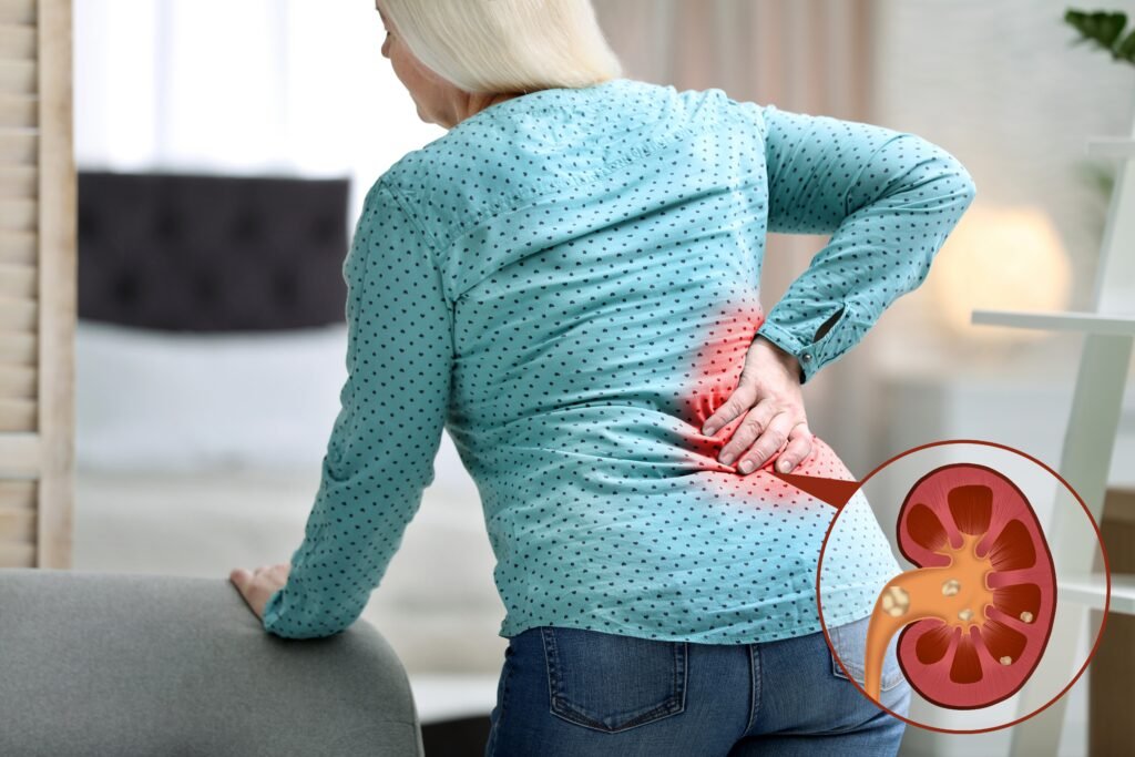 flank pain, renal colic, kidney stone symptoms
