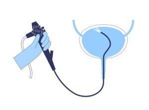 Cystoscopic Botox injection into the bladder for overactive bladder treatment