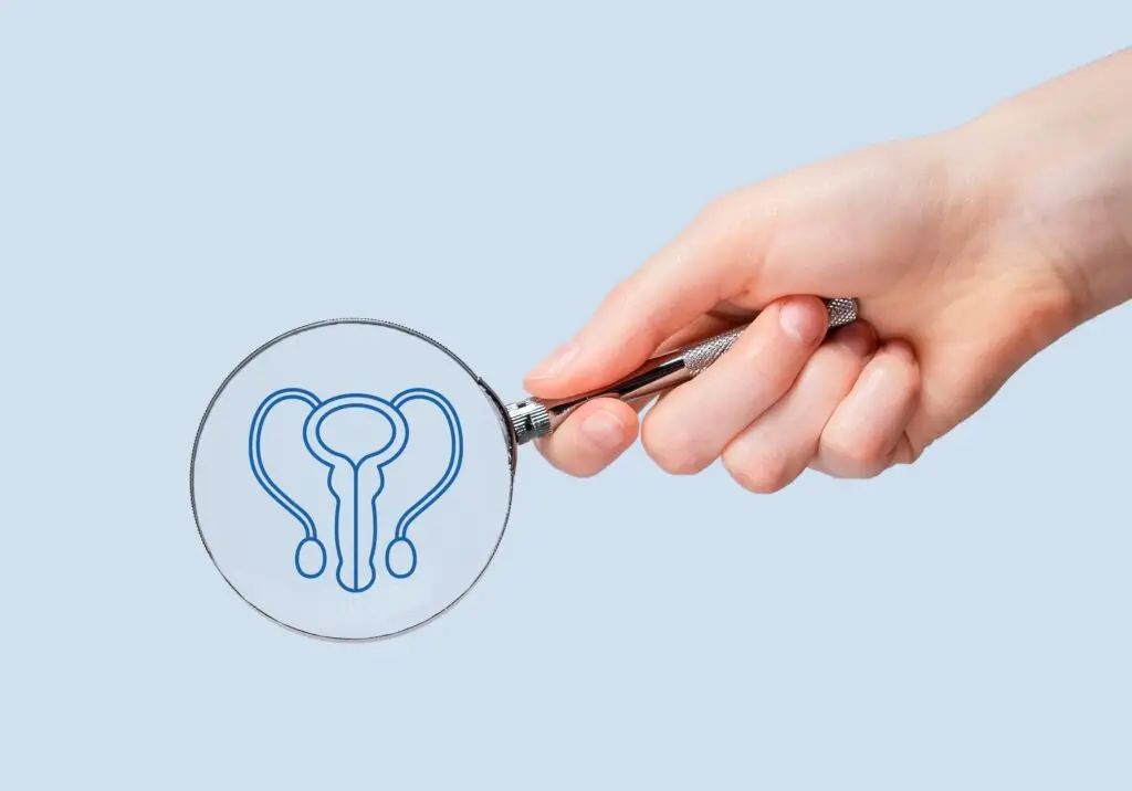Medical illustration representing varicocele assessment and male reproductive health