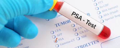 PSA screening for prostate cancer. A raised PSA is recommended for prostate biopsy.